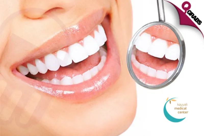 From QR1500 Improve the Appearance of Your Teeth with Veneers! (Up to QR12000 Value)